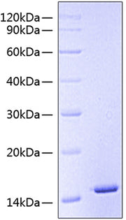 Recombinant Human CSF2RA/GM-CSF R alpha/CD116 Protein