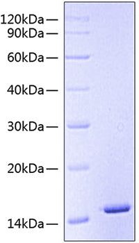 Recombinant Human CSF2RA/GM-CSF R alpha/CD116 Protein