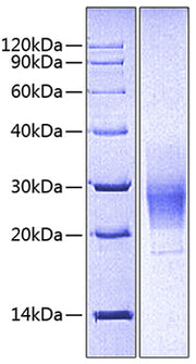 Recombinant Human CEACAM5/CEA/CD66e (323-500) Protein