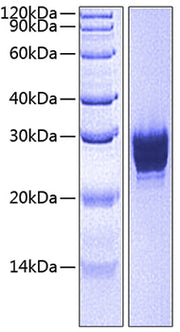 Recombinant Human CEACAM5/CEA/CD66e (501-685) Protein
