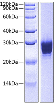 Recombinant Human CEACAM5/CEA/CD66e (501-685) Protein