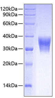 Recombinant Human CEACAM5/CEA/CD66e Protein
