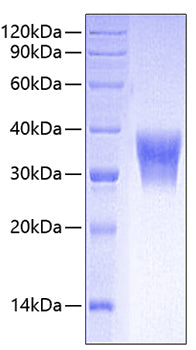 Recombinant Human CEACAM5/CEA/CD66e Protein