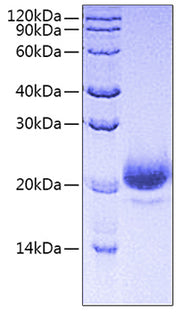 Recombinant Human CD44 Protein