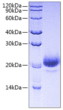 Recombinant Human CD44 Protein