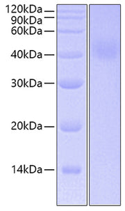 Recombinant Human IL-20RA Protein