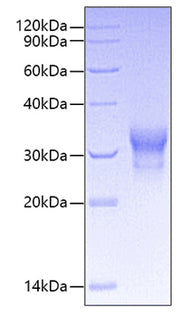 Recombinant Human TNFRSF5/CD40 Protein