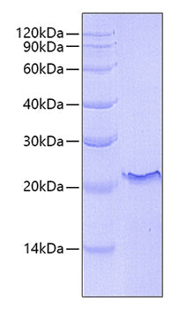 Recombinant Human TNFRSF5/CD40 Protein