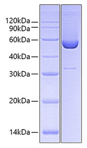 Recombinant Human Serpin H1/HSP47 Protein