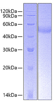 Recombinant Human TNFRSF8/CD30 Protein