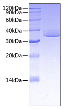 Recombinant Human TNFRSF8/CD30 Protein