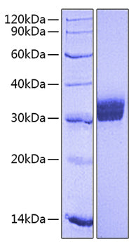Recombinant Human B7-1/CD80 Protein