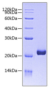 Recombinant Human B7-1/CD80 Protein