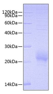 Recombinant Human BY55/CD160 Protein