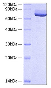 Recombinant Rat 5'-Nucleotidase/NT5E/CD73 Protein