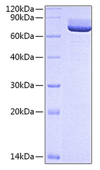 Recombinant Rat 5'-Nucleotidase/NT5E/CD73 Protein