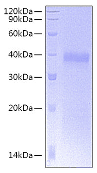 Recombinant Human CD8 alpha Protein