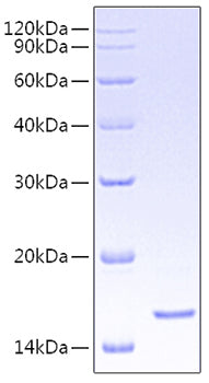 Recombinant Human CD5 Protein