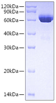Recombinant Human Tissue-type plasminogen activator/TPA/PLAT Protein