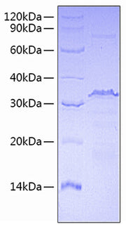 Recombinant Human Transcriptional Repressor Ctcf/CTCF Protein