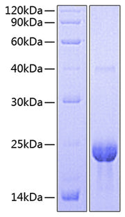 Recombinant HumanTNFRSF17/BCMA/CD269 Trimer Protein