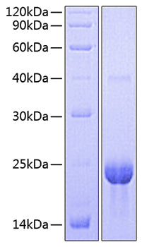 Recombinant HumanTNFRSF17/BCMA/CD269 Trimer Protein