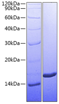 Recombinant Human ALCAM/CD166 Protein