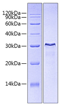 Recombinant Human CD3E&CD3D Protein