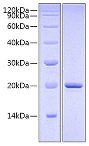 Recombinant Human IL-23A&Mouse IL-12B Protein