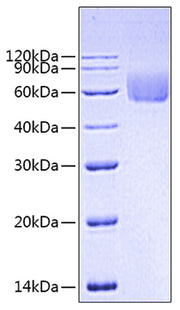 Recombinant Human IL-31 Protein
