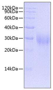 Recombinant Human B7-H3/CD276 Protein