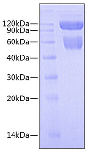Recombinant Human IL-27/IL-27A&IL-27B Protein
