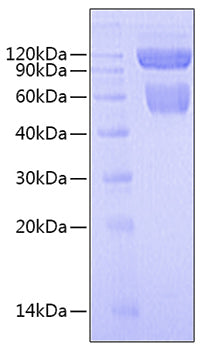 Recombinant Human IL-27/IL-27A&IL-27B Protein