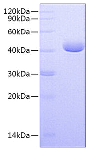 Recombinant Human Nectin-4/PVRL4 Protein