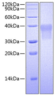 Recombinant Human PLAU/uPA Protein (pro form)