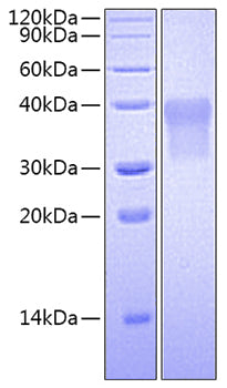 Recombinant Human PLAU/uPA Protein (pro form)