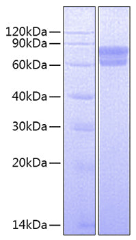 Recombinant Human uPA/PLAU Protein