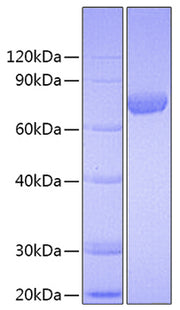 Recombinant Human C7orf50(Cholesin) Protein
