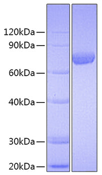 Recombinant Human C7orf50(Cholesin) Protein