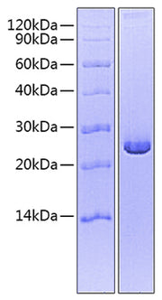 Recombinant Mouse/Rat Mature TGF-beta 2 Protein