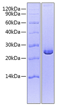 Recombinant Mouse/Rat Mature TGF-beta 2 Protein