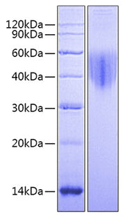 Recombinant Mouse Alkaline Phosphatase (Germ type) /ALPG Protein