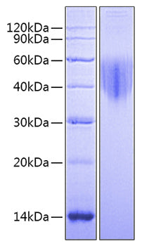 Recombinant Mouse Alkaline Phosphatase (Germ type) /ALPG Protein