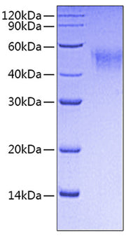 Recombinant Mouse Fc gamma RI/FCGR1/CD64 Protein
