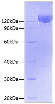Recombinant Mouse PDGFR-alpha/CD140a Protein