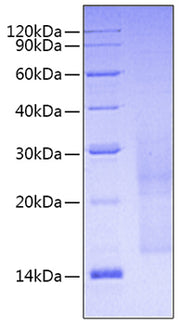 Recombinant Human LGR5 / GPR49 protein