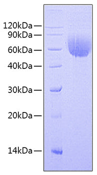 Recombinant Human BLNK Protein