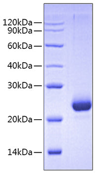 Recombinant Human Mature BMP-10 Protein