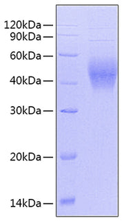 Recombinant Human GAPDH Protein