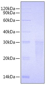 Recombinant Human TMIGD2/CD28H Protein
